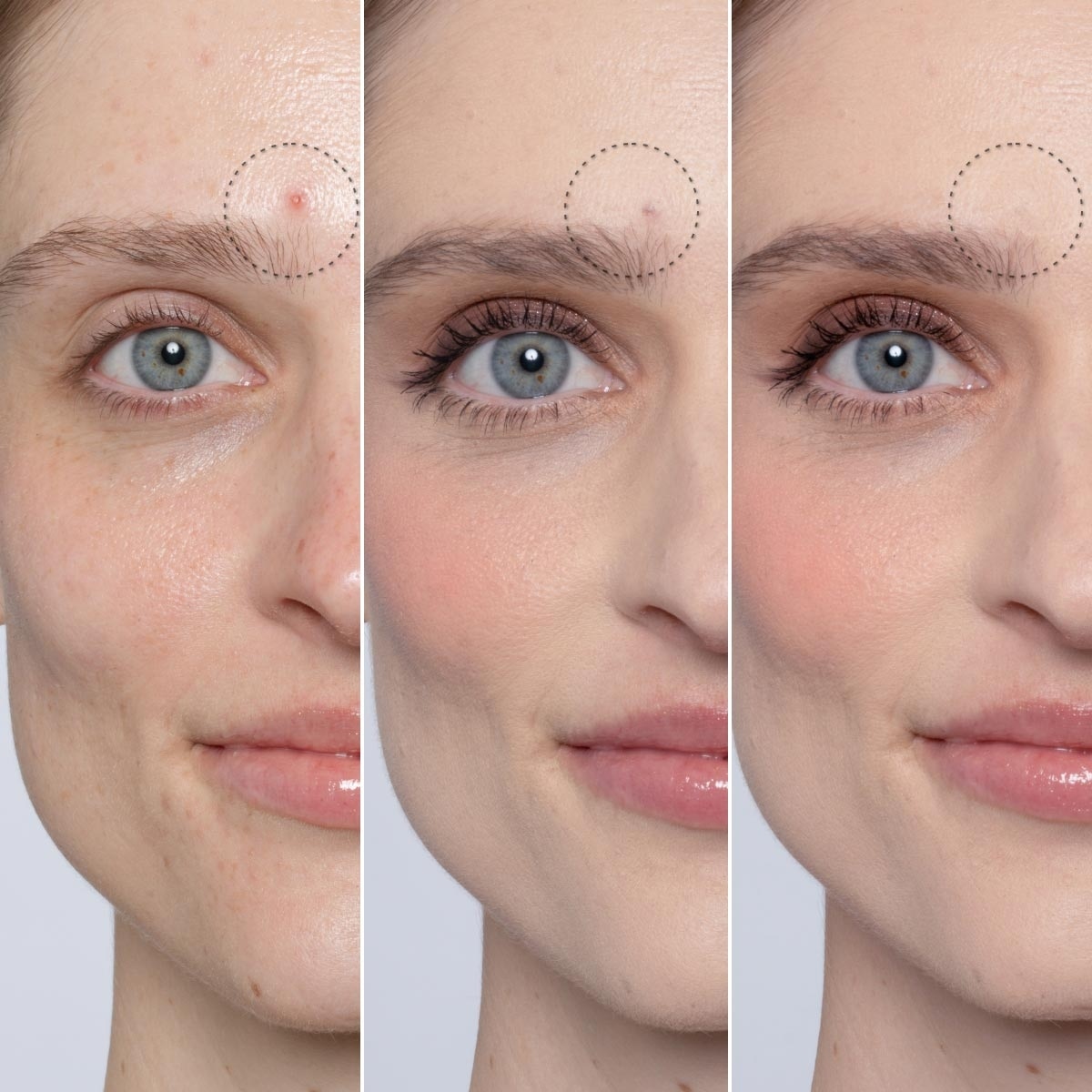 BLEMISH DEFEAT'R BHA SPOT TARGETING GEL (GEL FACIAL CON ÁCIDO SALICÍLICO)
